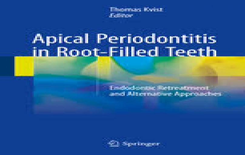 Apical Periodontitis in Root-Filled Teeth-download