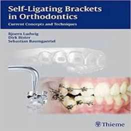 Self-ligating Brackets in Orthodontics-Current Concepts and Techniques ( 2012)