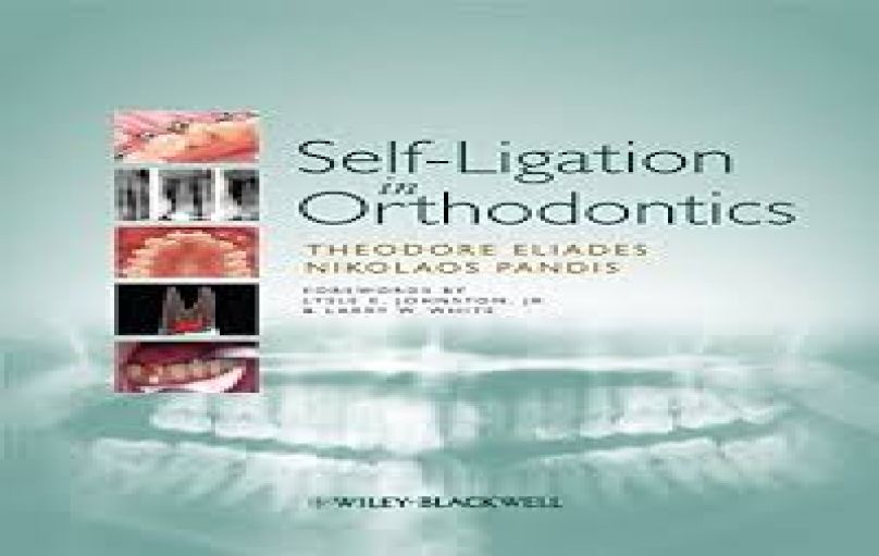 Self-Ligation in Orthodontics-download