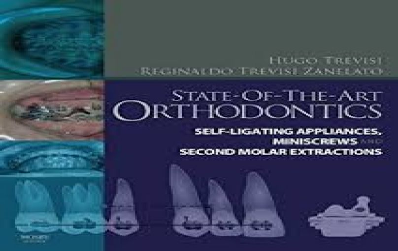 State of the Art Orthodontics- Self-Ligating Appliances-Miniscrews and Second Molars Extraction(2011)-download