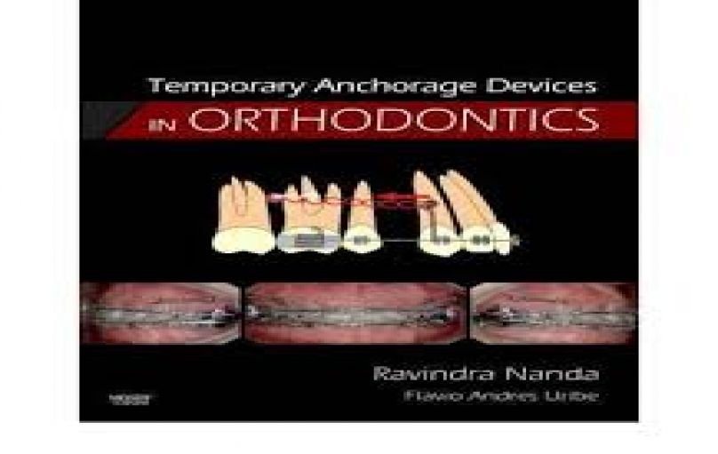Temporary Anchorage Devices in Orthodontics-Mosby-1 edition (2008)-download