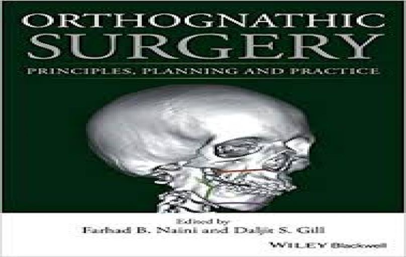 Orthognathic Surgery Principles, Planning and Practice-download