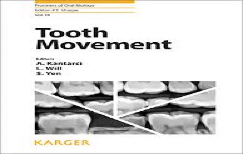 Tooth Movement-download