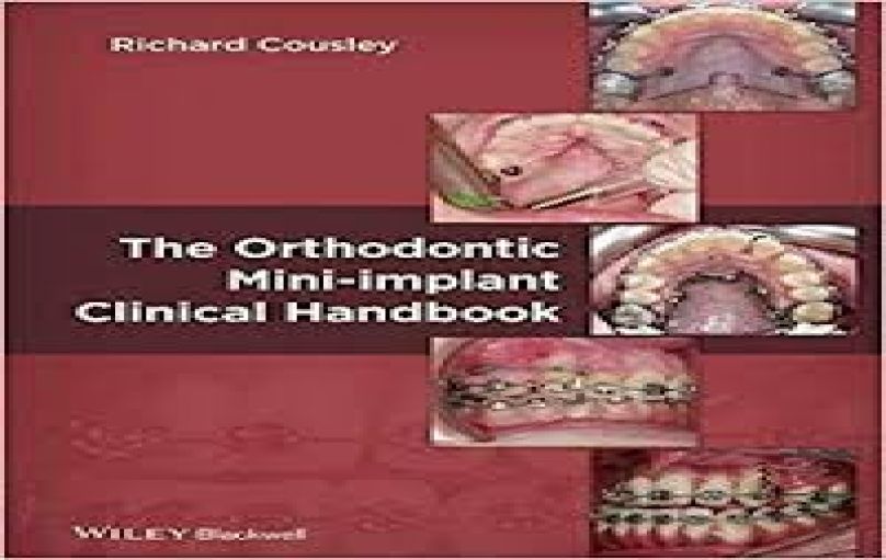 The Orthodontic Mini-implant Clinical Handbook (2013)-download