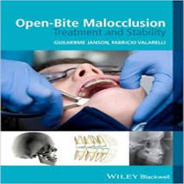 Open-Bite Malocclusion Treatment and Stability 2014
