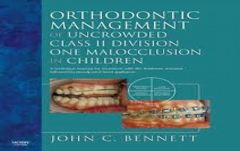 Orthodontic Management of Uncrowded Class II Division One Malocclusion in Children-download