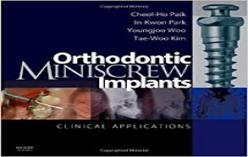 Orthodontic Miniscrew Implants- Clinical Applications (2008)-download
