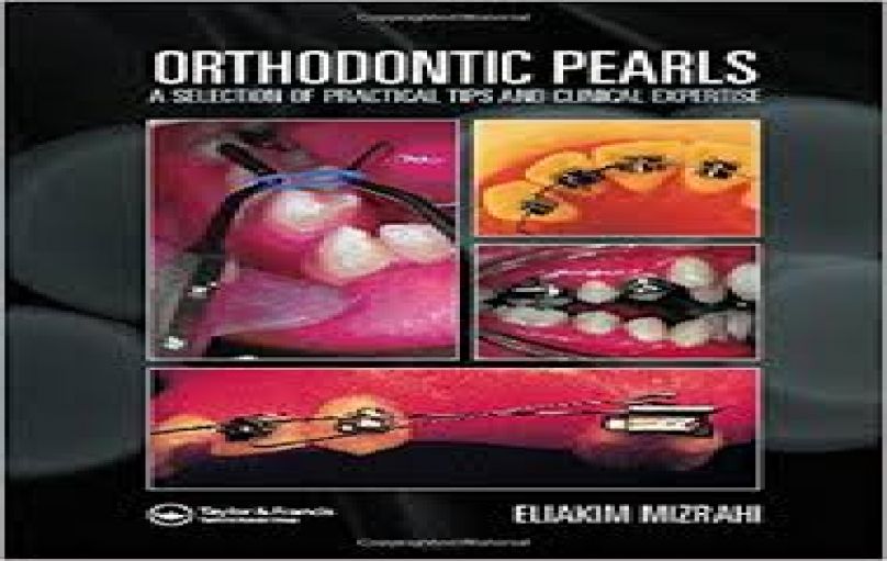Orthodontic Pearls- A Selection of Practical Tips and Clinical Expertise (2004)-download