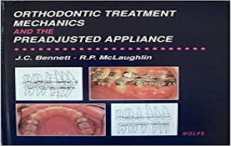 Orthodontic  treatment mechanics and the preadjusted appliance-download