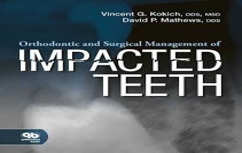 Orthodontic and Surgical Managent of Impacted Teeth (2014)-download