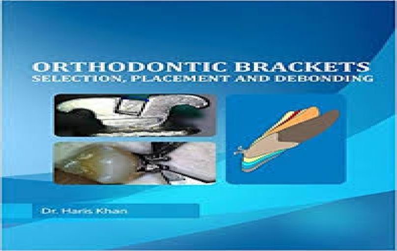 Orthodontic brackets selection placement and debonding-2016-download