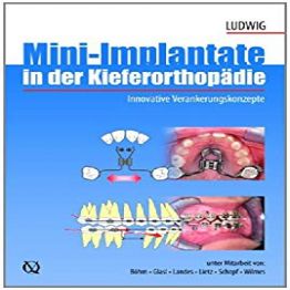 Mini-implants in Orthodontics-Innovative Anchorage Concepts (2008)