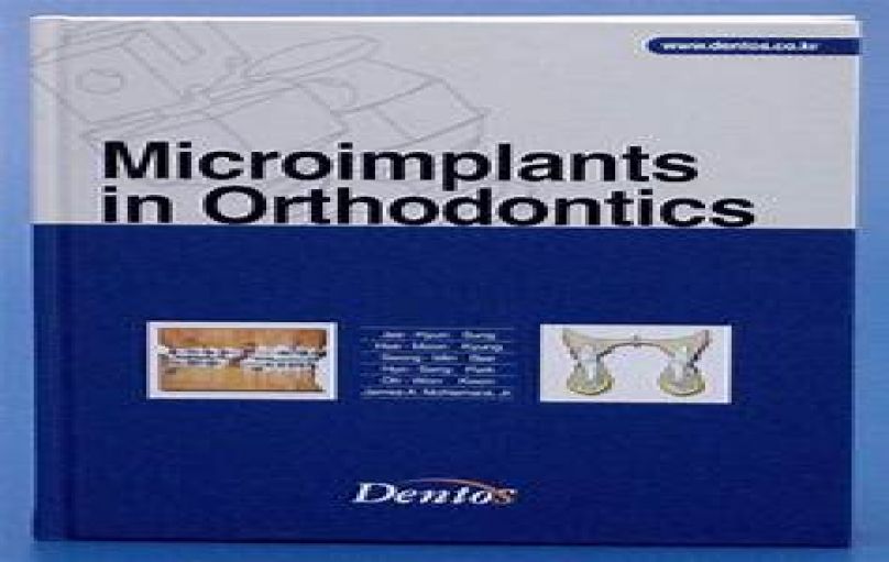 Microimplants in Orthodontics, 1st Edition (Dentos)-download