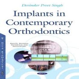 Implants in Contemporary Orthodontics-2016
