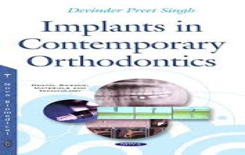 Implants in Contemporary Orthodontics-2016-download