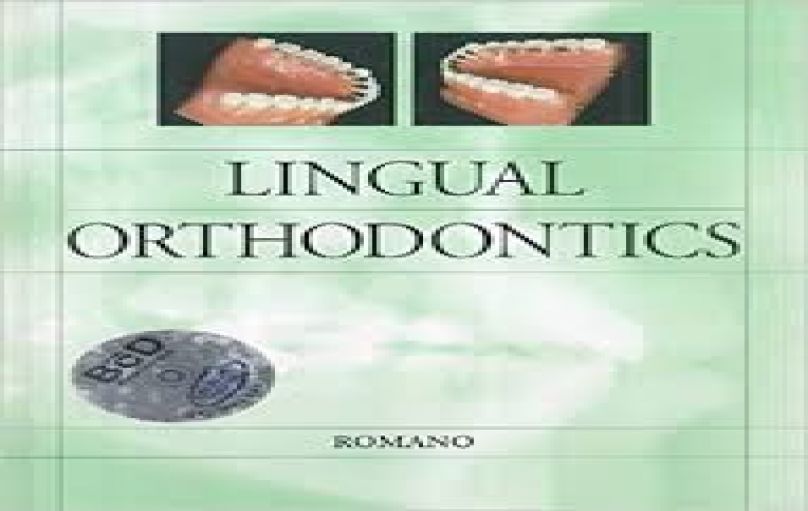Lingual Orthodontics-download