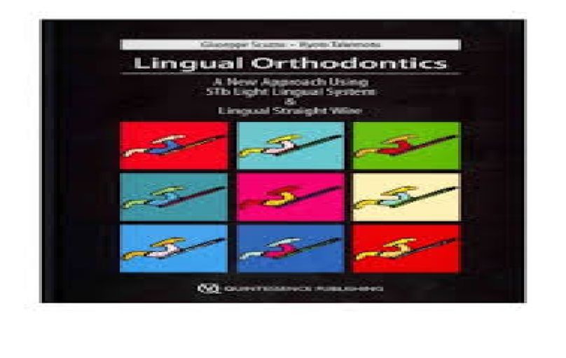 Lingual Orthodontics-A New Approach Using STb Light Lingual System and Lingual Straight Wire-download