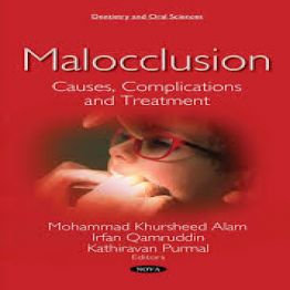 Malocclusion Causes Complications and Treatment
