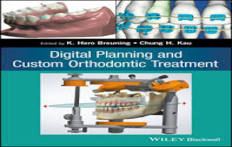 Digital Planning and Custom Orthodontic Treatment-download