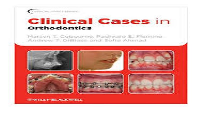 Clinical Cases in Orthodontics, 1ed (2012)-download