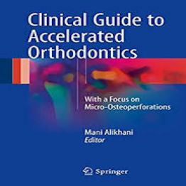 Clinical Guide to Accelerated Orthodontics 
