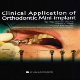Clinical Applications of Orthodontic Mini-implants(2008)