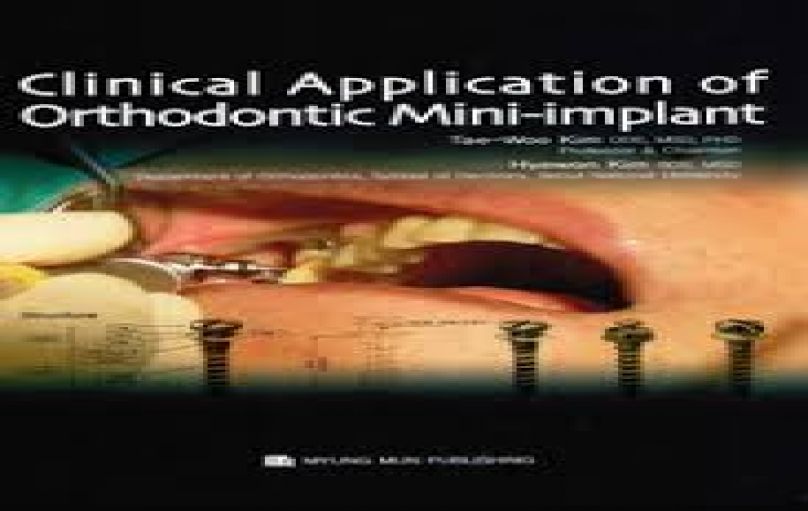 Clinical Applications of Orthodontic Mini-implants(2008)-download