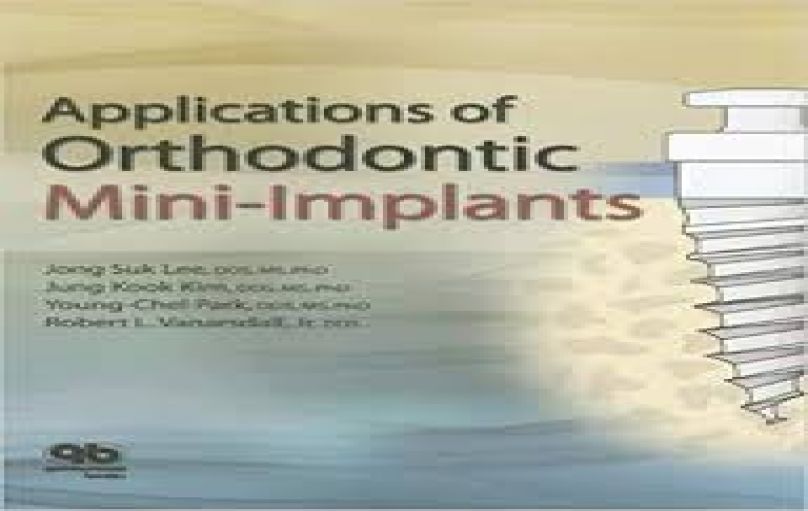 Applications of Orthodontic Mini-Implants (2007)-download