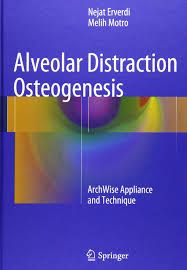 Alveolar Distraction Osteogenesis