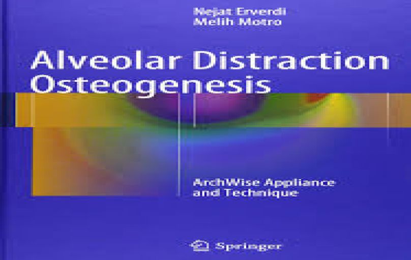 Alveolar Distraction Osteogenesis-download