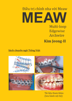 ĐIỀU TRỊ CHỈNH NHA VỚI MEAW