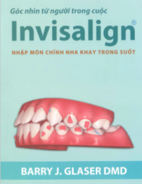 INVISALIGN – NHẬP MÔN CHỈNH NHA KHAY TRONG SUỐT