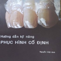 HƯỚNG DẪN KĨ NĂNG PHỤC HÌNH CỐ ĐỊNHH