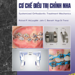 CƠ CHẾ ĐIỀU TRỊ CHỈNH NHAA