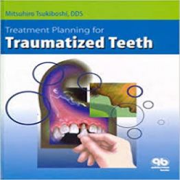 Treatment Planning for Traumatized Teeth -1st-edition