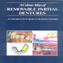 A Colour Atlas of Removable Partial Dentures - Mosby (1989)