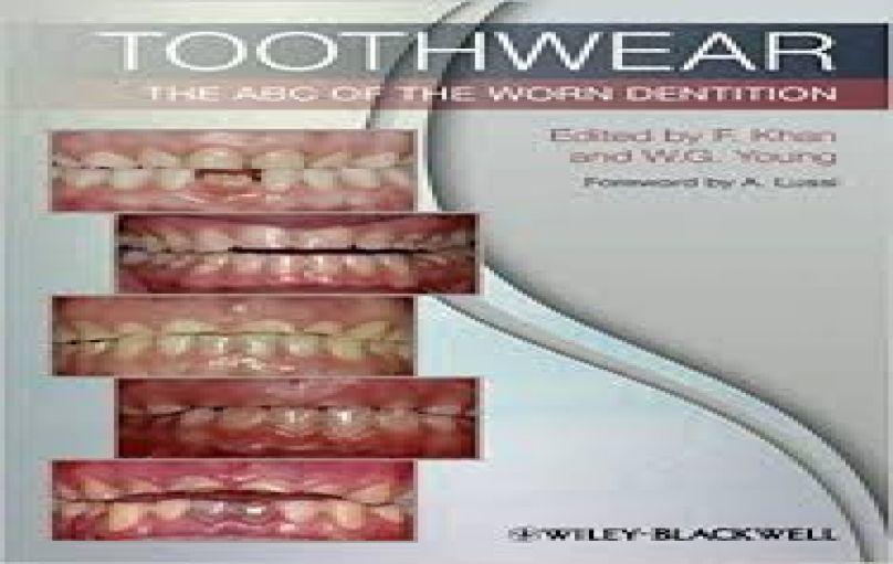 Toothwear-The ABC of the Worn Dentition-download