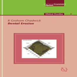 Dental Erosion - QuintEssentials, Clinical Practice 4,