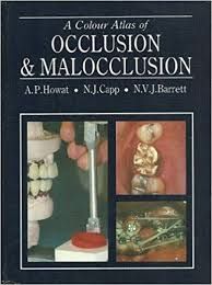 Color Atlas of Occlusion & Malocclusion