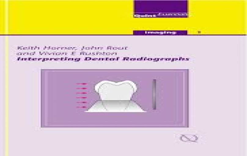 Interpreting Dental Radiographs - QuintEssentials-2002-download