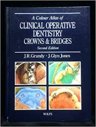 A Colour Atlas of Clinical Operative Dentistry Crowns and Bridges-2nd-edition(1992)-download
