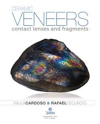 Ceramic veneers contact lenses and fragments-download