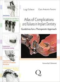 Atlas of Complications and Failures in Implant Dentistry-download